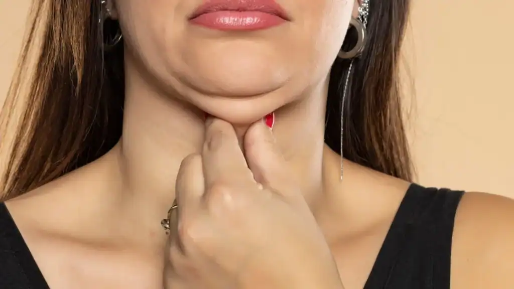 An image of a woman with double chin, sad, worried : Non Surgical Double Chin Removal Treatment in Daventry, UK