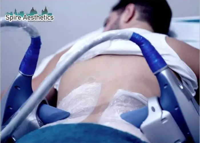 Man having fat freezing treatment done on love handles before a competitions Daventry to create a sculpted look.