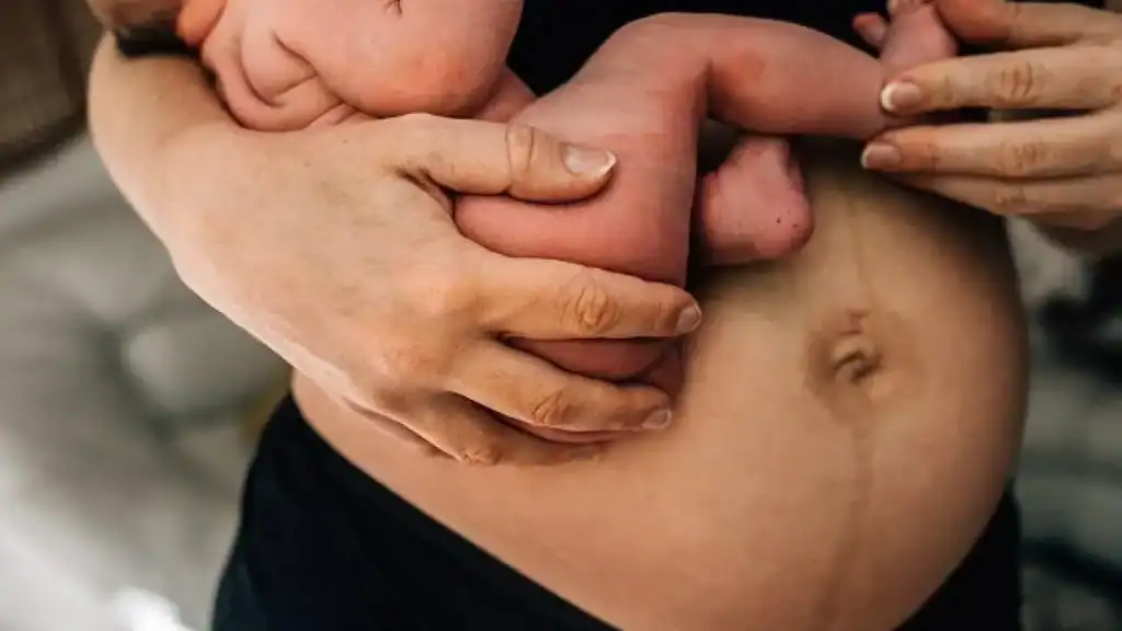 Why Is My Stomach Still Big After Pregnancy Daventry?