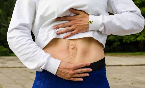 When Could Diastasis Recti Be the Missing Piece of the Puzzle Daventry?